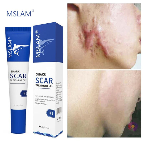 Scar Removal Cream Gel