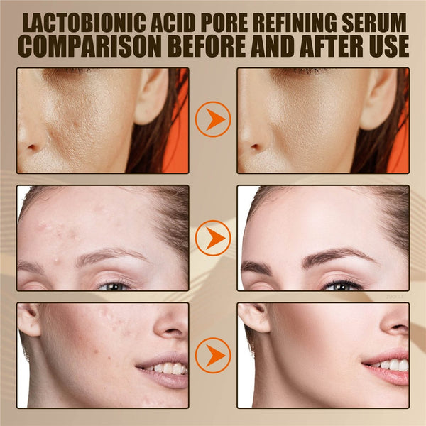 Lactobionic Acid Pore Refining Serum