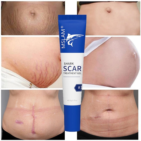 Scar Removal Cream Gel